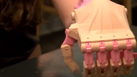 Company provides free prosthetics for East Aurora woman