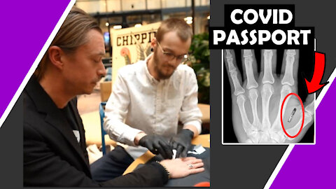 Sweden Start Putting Covid Passport Microchip In Hands #MarkOfTheBeast / Hugo Talks #lockdown