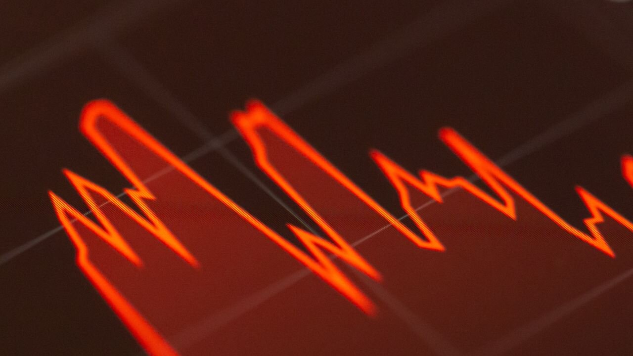 Why 3 in 5 Americans think the economy is in a recession
