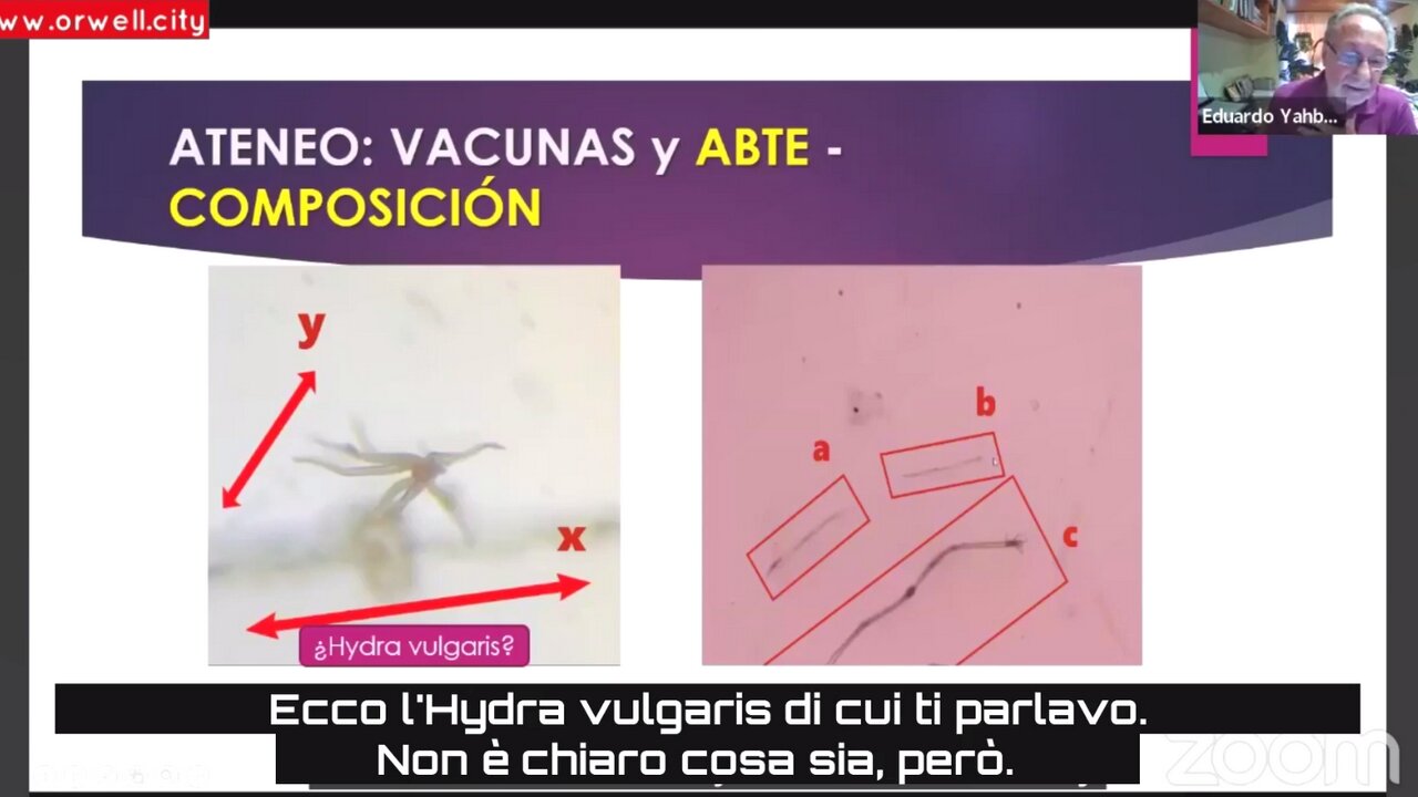 Dr.Yahbes & Dr.Stokes:"Vaccini" contengono Nanotecnologia,Parassiti diversi,Hydra-DARPA Hydrogel=ARMI contro L'UMANITA'