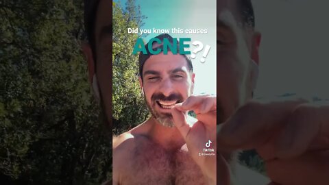 How I got rid of my acne 🤗 #short