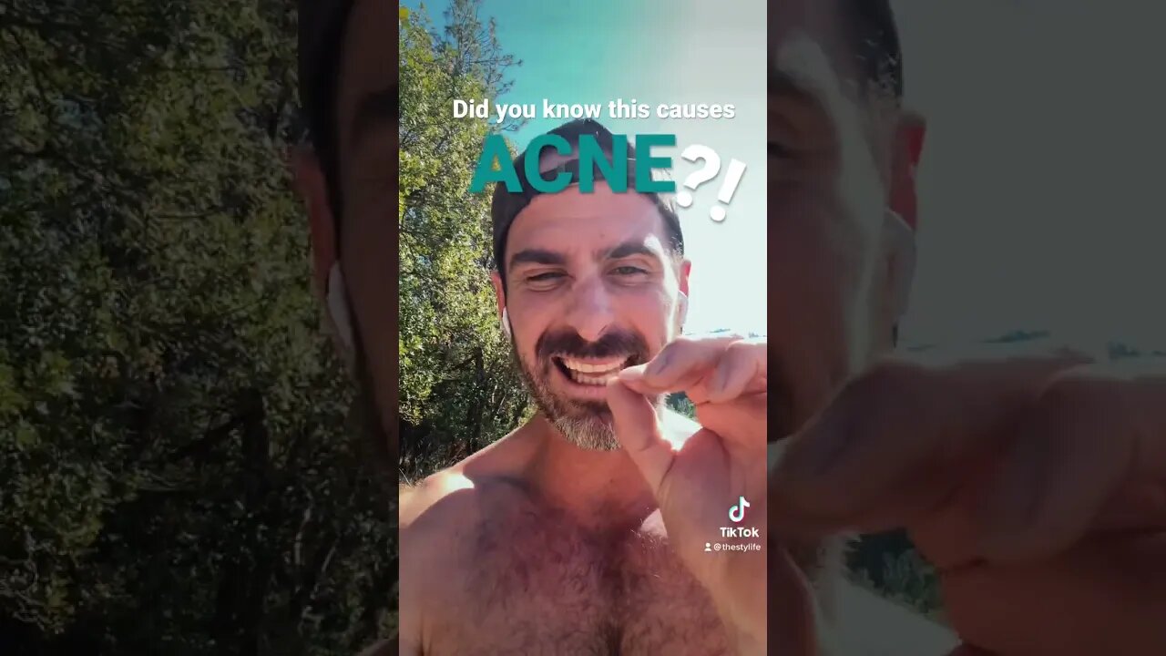 How I got rid of my acne 🤗 #short