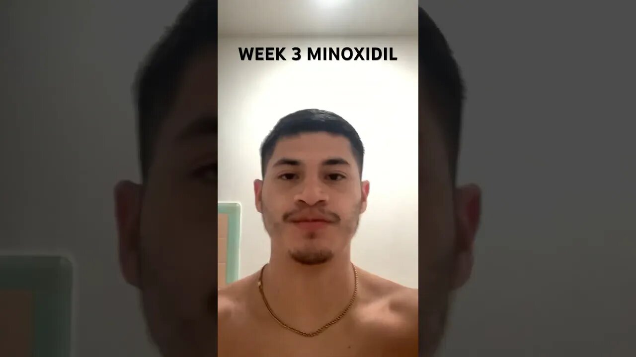 WEEK 3 USING MINOXIDIL #shorts