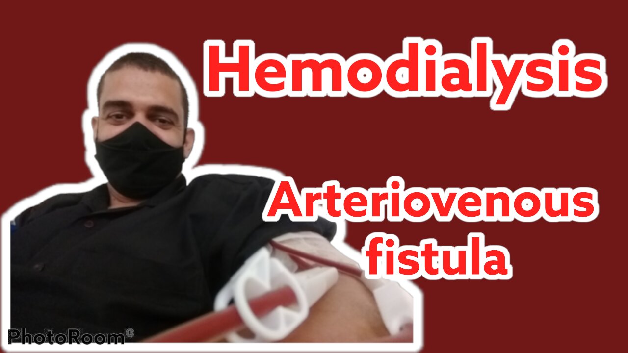 Hemodialysis arteriovenous fístula