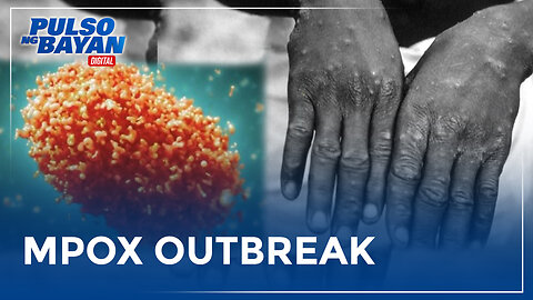 Mga Pinoy sa Kenya, pinag-iingat sa gitna ng MPOX outbreak