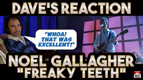 Dave's Reaction: Noel Gallagher Freaky Teeth