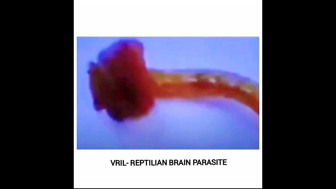 VRIL PARASITE