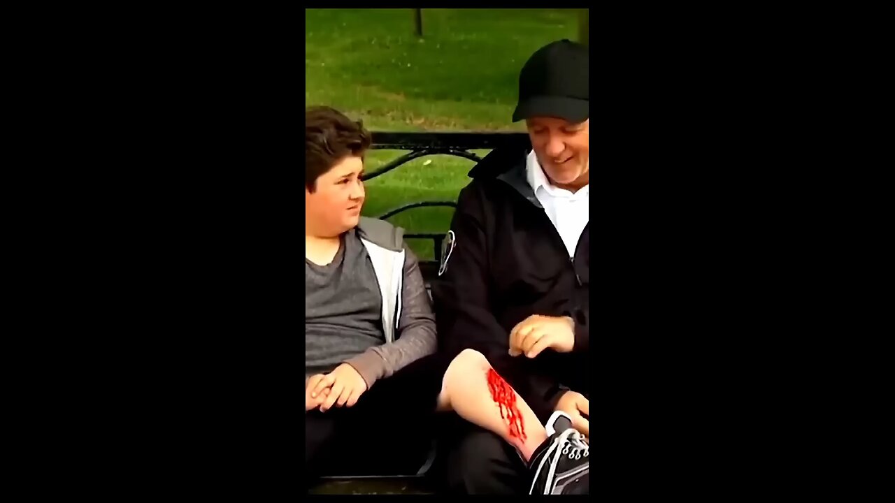 boy prank on blood on his leg