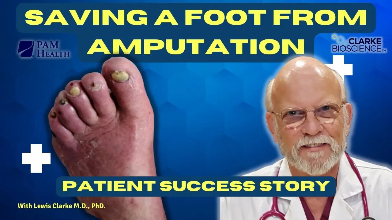 Dr. Clarke Saves a Foot From Amputation Without Using Drugs | Patient Success Story | Mr. Crnkovic