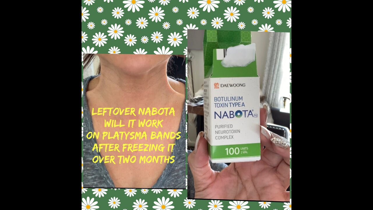 Doing Platysma bands with leftover Nabota after freezing over two months?