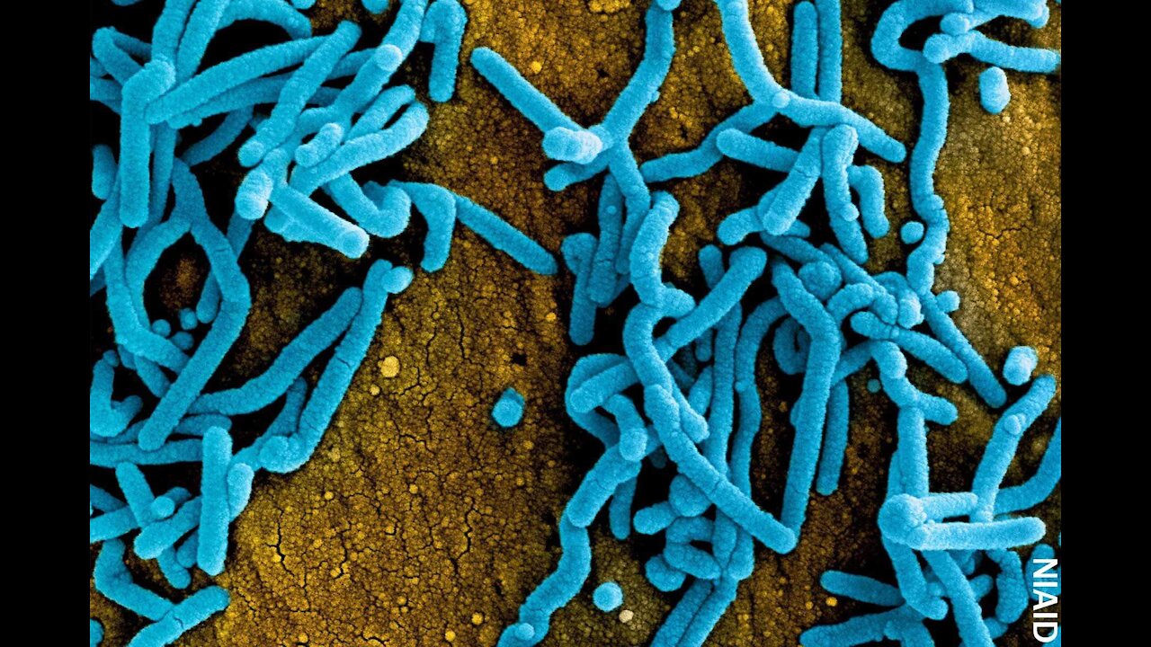 Deadly Ebola-likeDeadly Ebola-like Marburg virus could ‘spread far and wide’ if not stopped: WHO