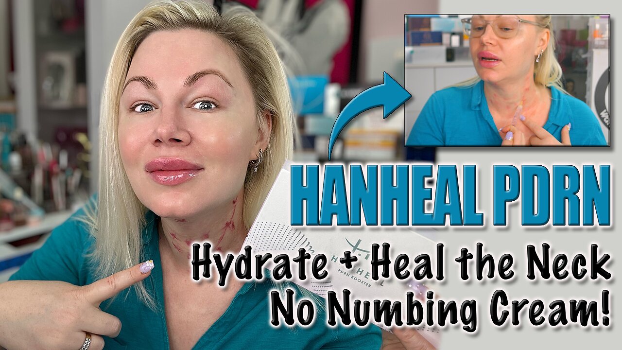 Hydrate & Heal the Neck Tissue with Hanheal PDRN, No Numbing Cream! AceCosm | Code Jessica10 Saves