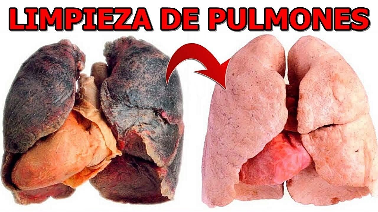 LIMPIAR Y DESINTOXICAR TUS PULMONES Y VIAS RESPIRATORIAS DE FORMA FACIL