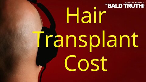 Hair Transplant Cost - The Truth The Bald Truth November 22, 2019