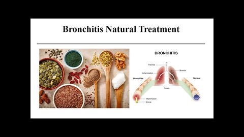 Bronchitis Natural Treatment Options