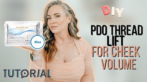 PDO Thread Lift for Cheek Volume