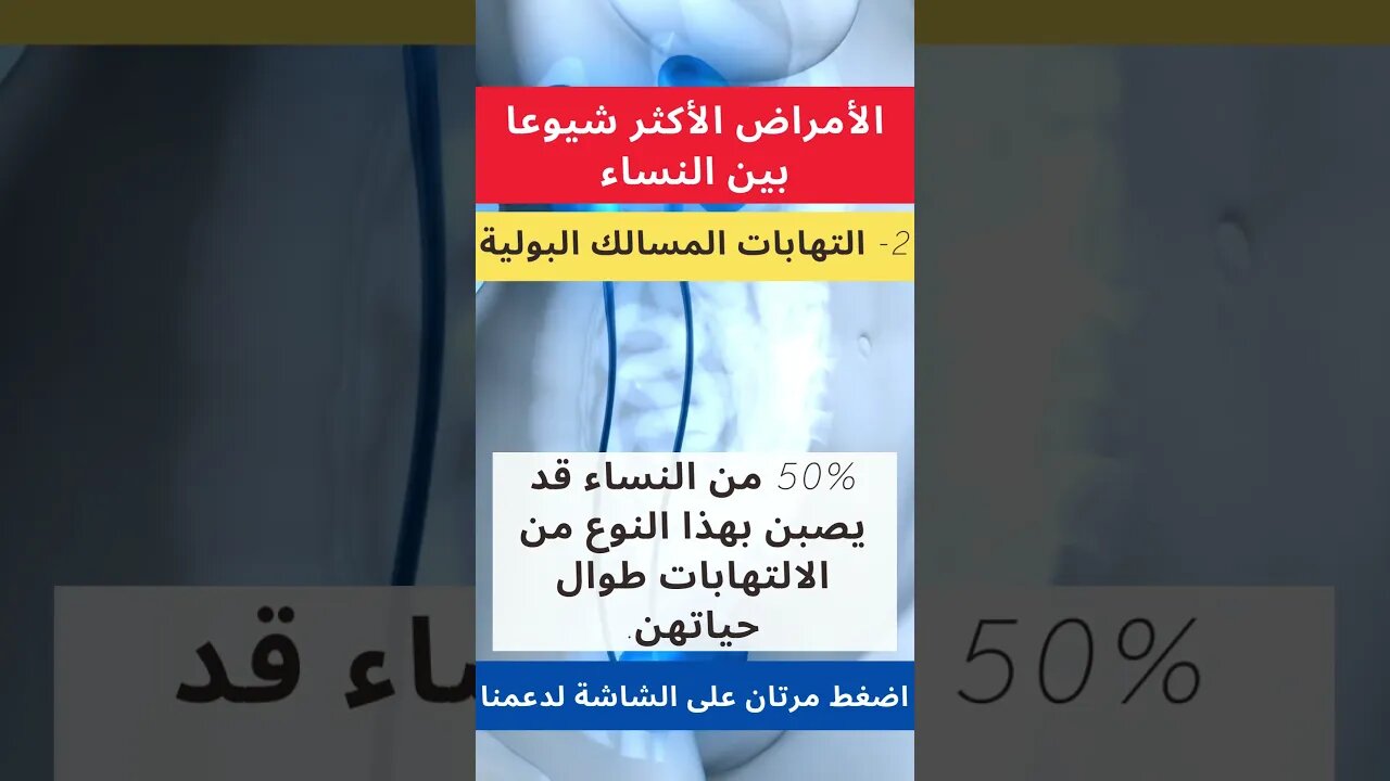 للسيدات فقط .. الأمراض الأكثر شيوعا بين النساء في دقيقة #المرأة