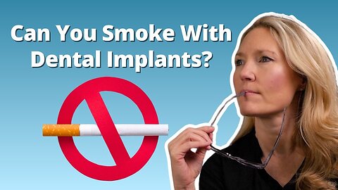 Smoking And Dental Implants: What You Should Know.