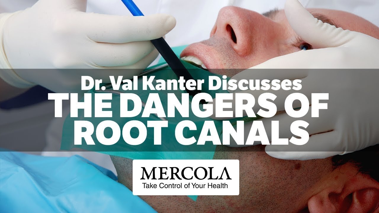 Root Canal Dangers- Interview with Dr. Val Kanter and Dr. Mercola