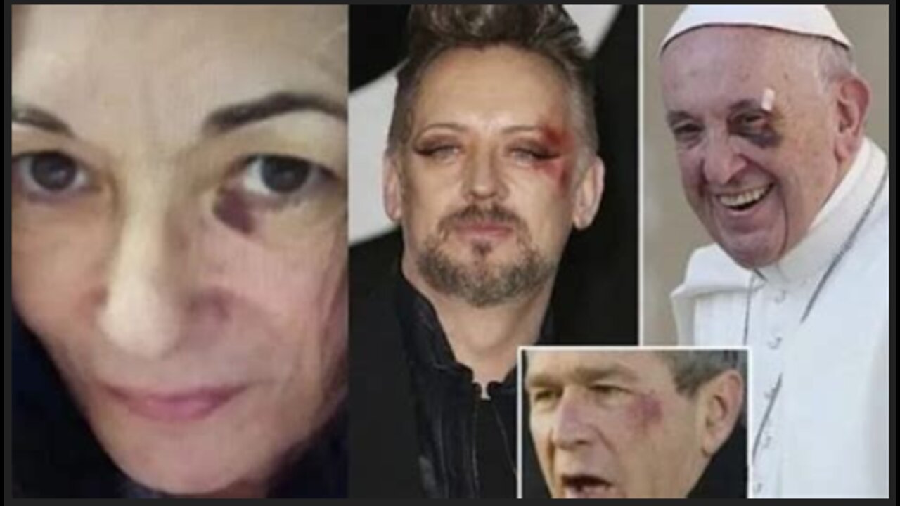 THE BLACK EYE CLUB ~ THEORY 2 ADRENOCHROME