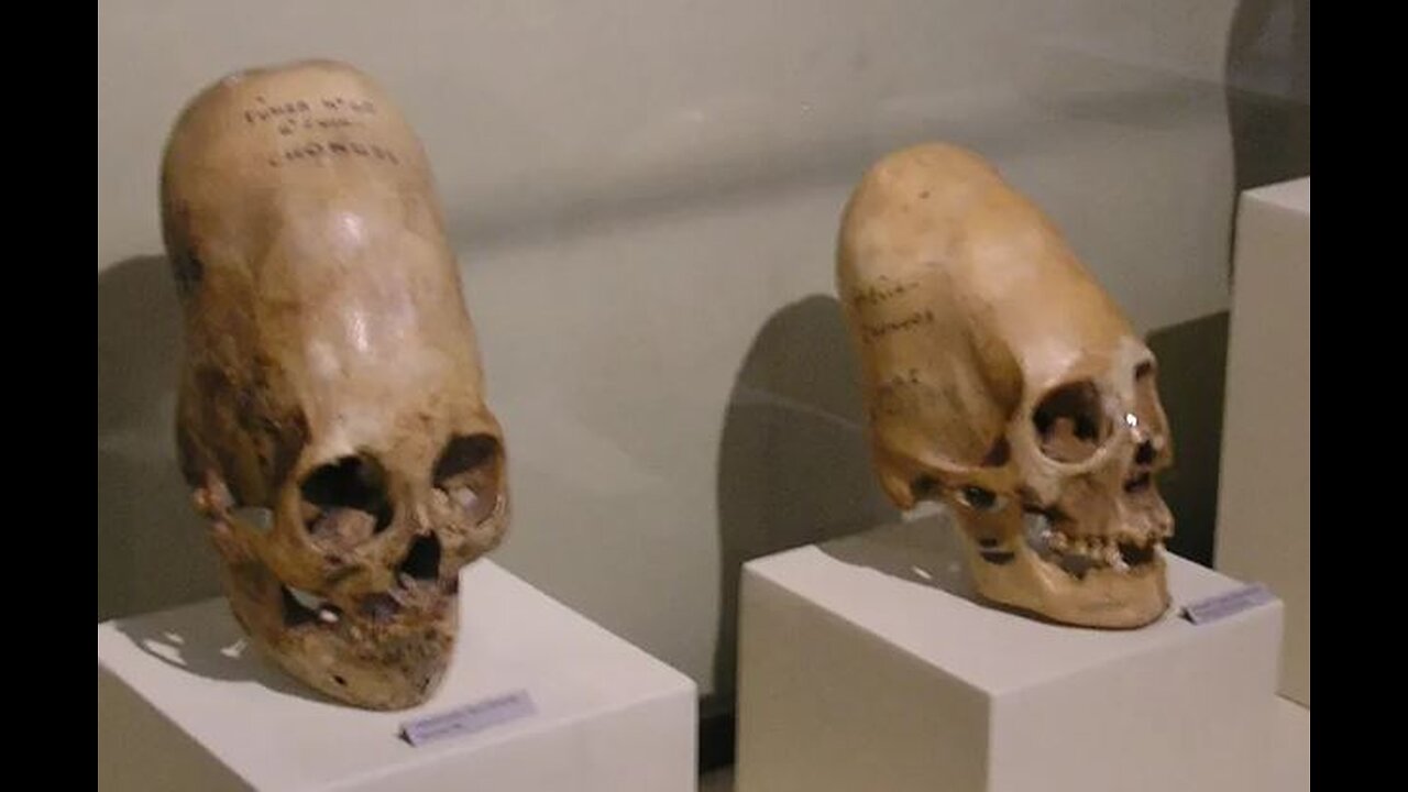Elongated & Conehead Skulls Are Extraterrestrial