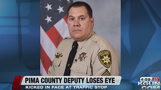 Deputy loses eye after being kicked during DUI arrest