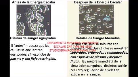 Máquina de energia escalar radiante depoimento cliente