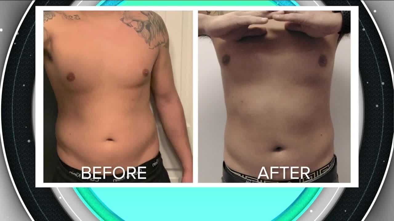 Help Losing Fat // Absolute Beauty Solutions