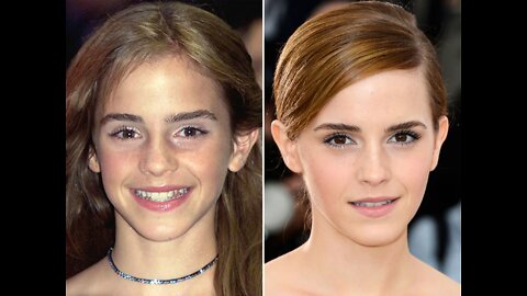 Top 10 Awkward Child Celebrities Who Became Hot. Became Famous for Their Looks.