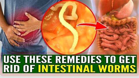 5 Foods That Kill Intestinal Worms Naturally