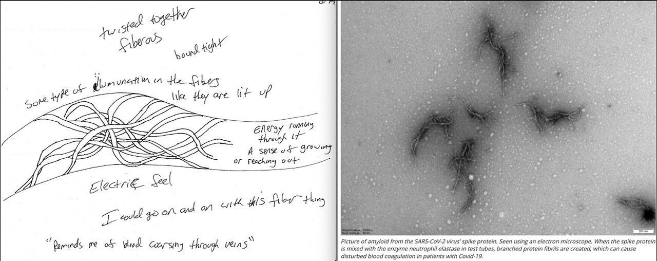 June 5 2022: Remote Viewing: Update to the Update of Ominous Feeling, Amyloid Clots