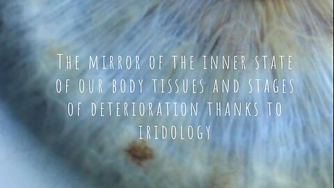 The mirror of the inner state of our body tissues and stages of deterioration thanks to iridology