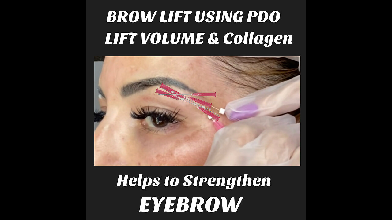 Lifted Eyelids And Boost Collagen