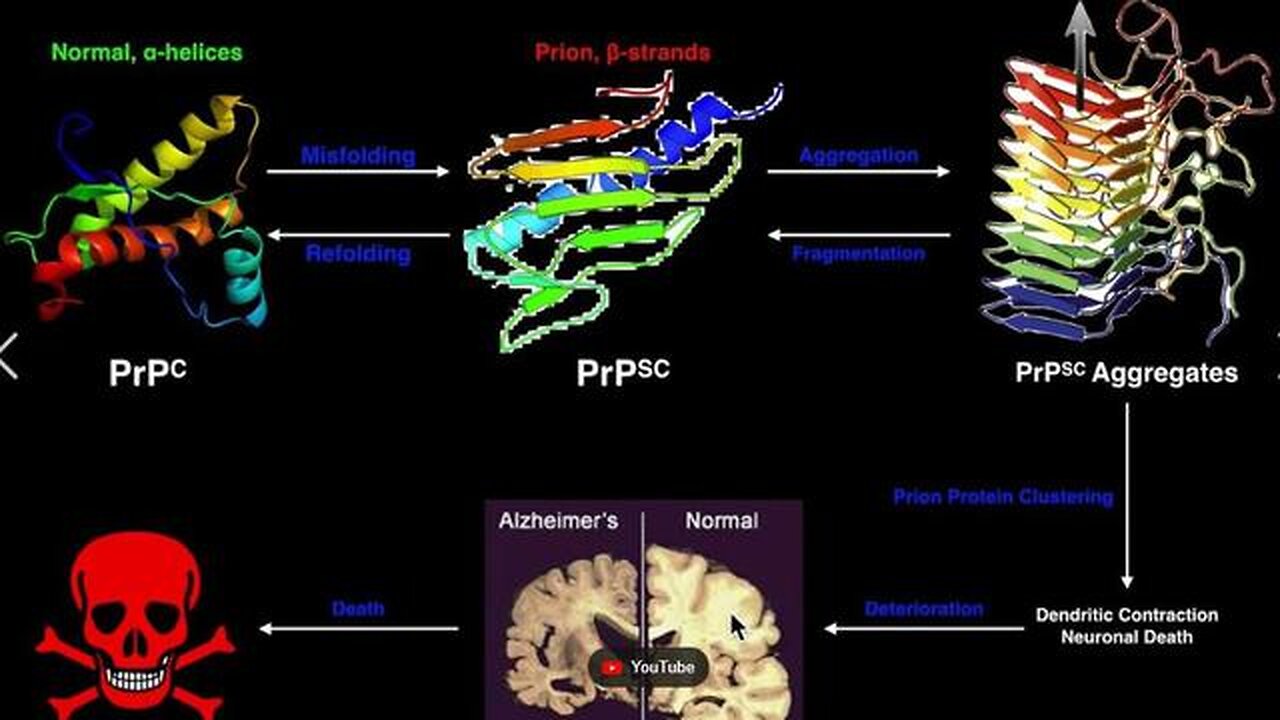 ALL Diseases Caused by Parasites, Prions, Funguses & Poisons? - Kim Paddock