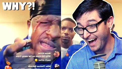 GUY LIGHTS FIRECRACKER IN HIS OWN EYE?!