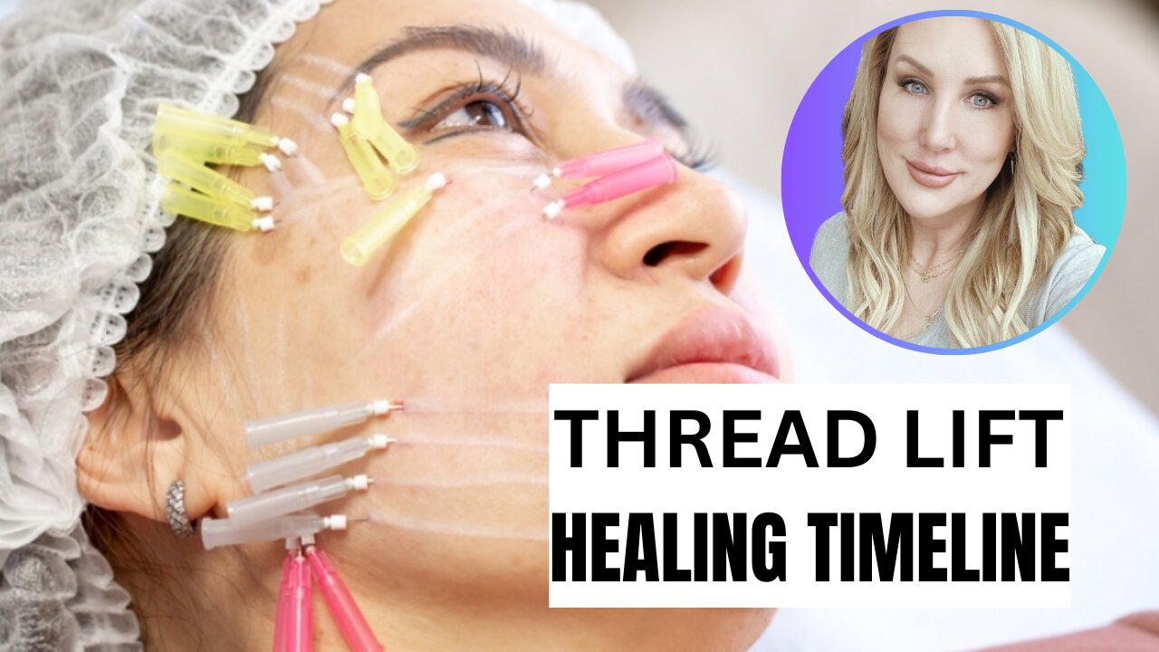 THREAD LIFT UPDATE // HEALING TIMELINE