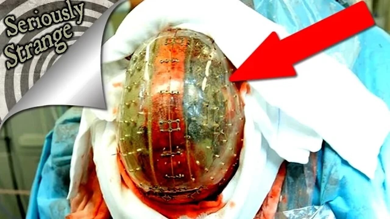 3 Unbelievable Medical Breakthroughs | SERIOUSLY STRANGE #42