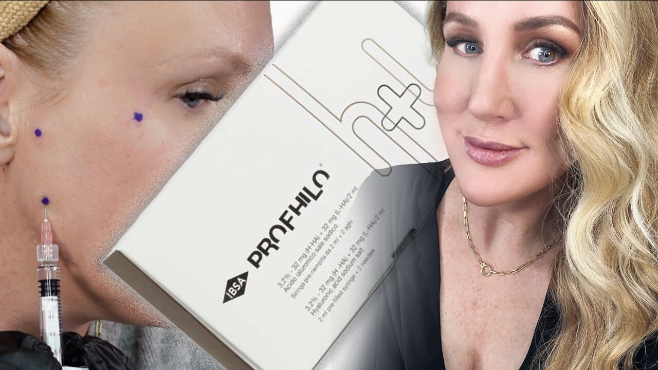 DIY Profhilo Using the BAP Technique | Facial Rejuvenation