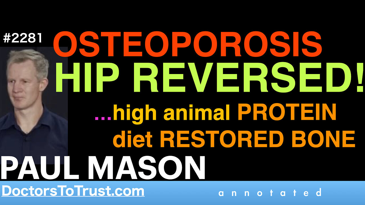 PAUL MASON o2 | OSTEOPOROSIS HIP REVERSED! …high animal PROTEIN diet restored bone