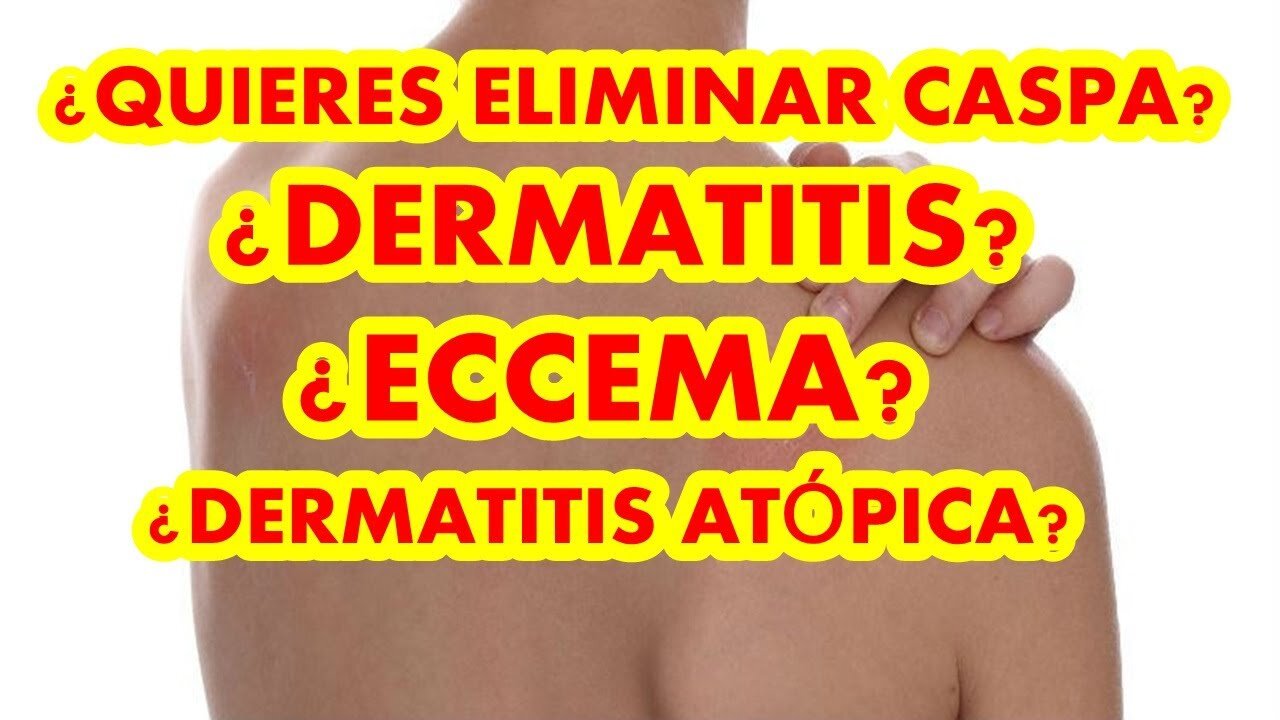 BINAURAL PARA DERMATITIS, ECCEMA, CASPA, PITIRIASIS, DERMATITIS ATÓPICA