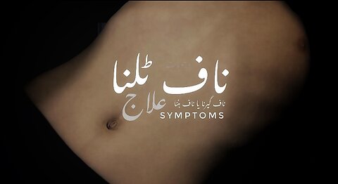 Navel Displacement - Causes - Symptoms & Treatment | ناف کا ٹلنا یا ہٹنا کیا ہے