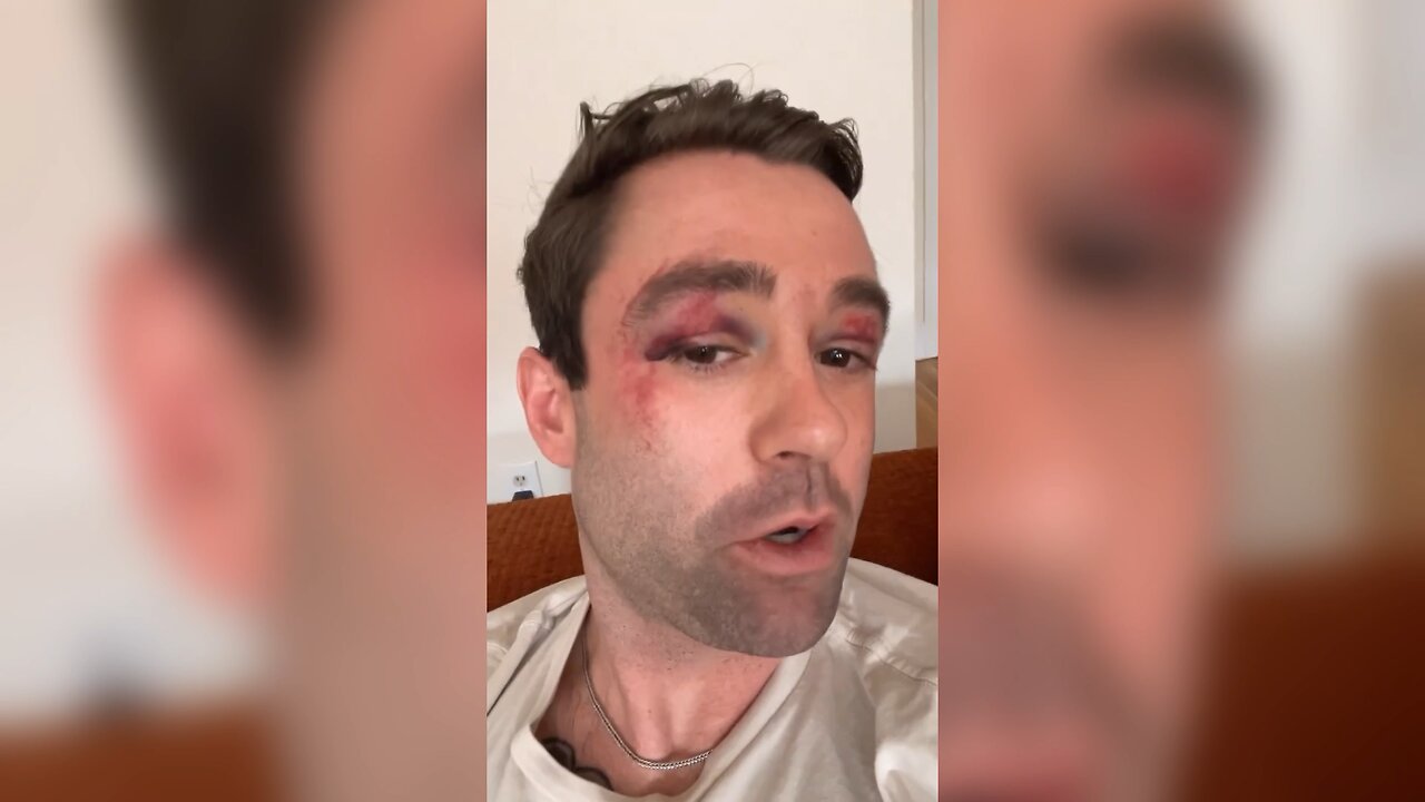 FOX News Meteorologist Violently Beaten on New York Subway