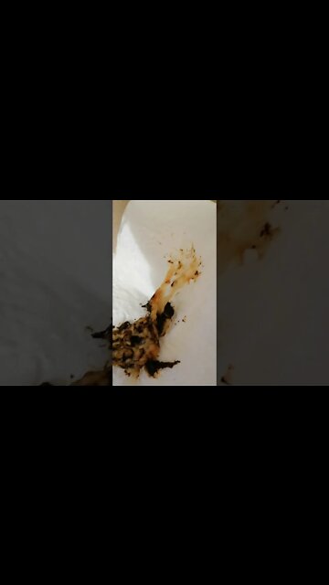 GRAPHIC WARNING, Day 8 Liquid Fasting, my first bowel movement DO NOT WATCH IF SENSITIVE TO FECES