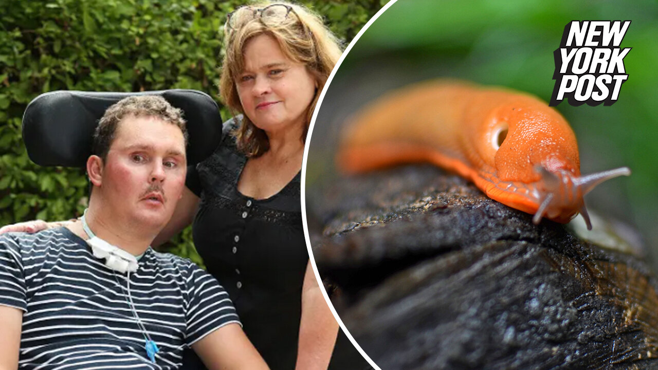 Man dies 8 years after being dared to eat slug