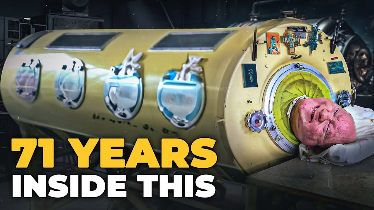 This Man Spent 71 Years in this Iron Lung