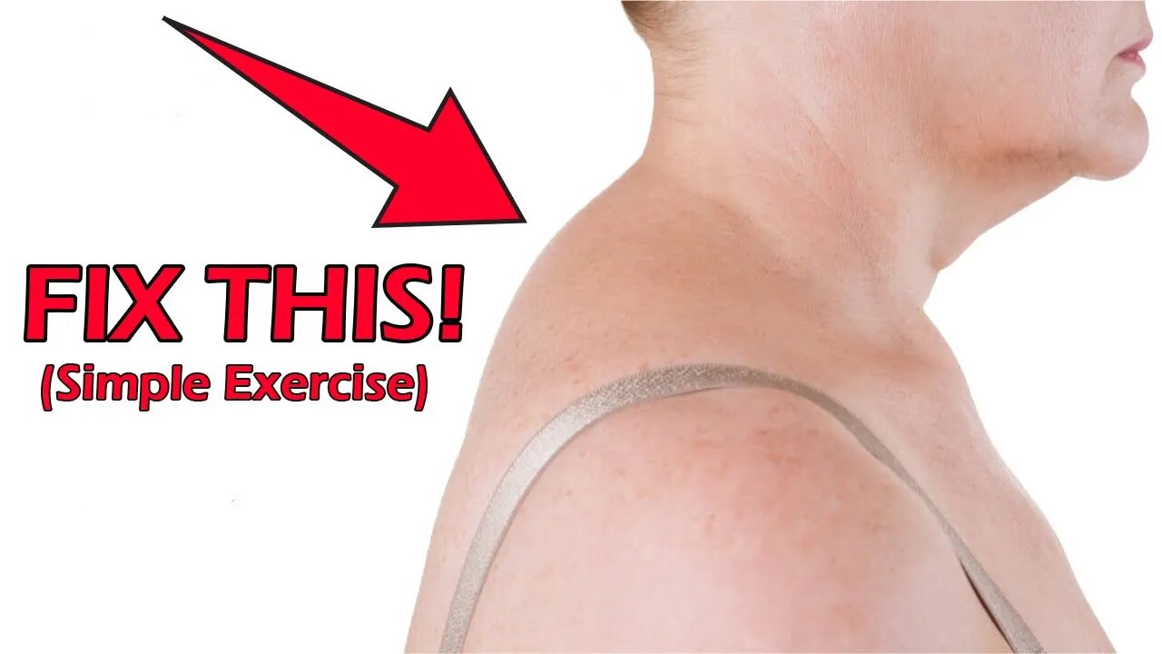 How To Fix Your Neck Hump With This Simple Exercise (EASY)