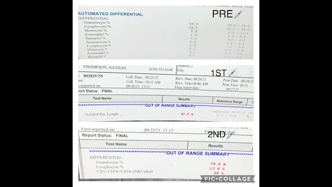 Immune system tests before and after COVID jabs