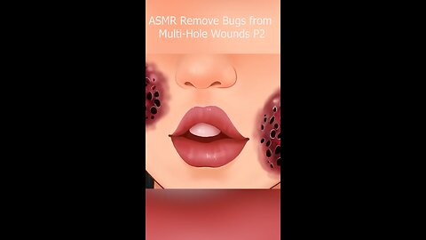 ASMR Remove Bugs from Multi-Hole Wounds