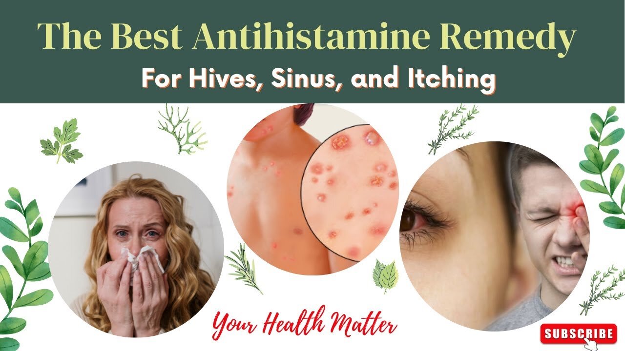 The Best Antihistamine Treatment | Remedy For Hives, Sinus, and Itching