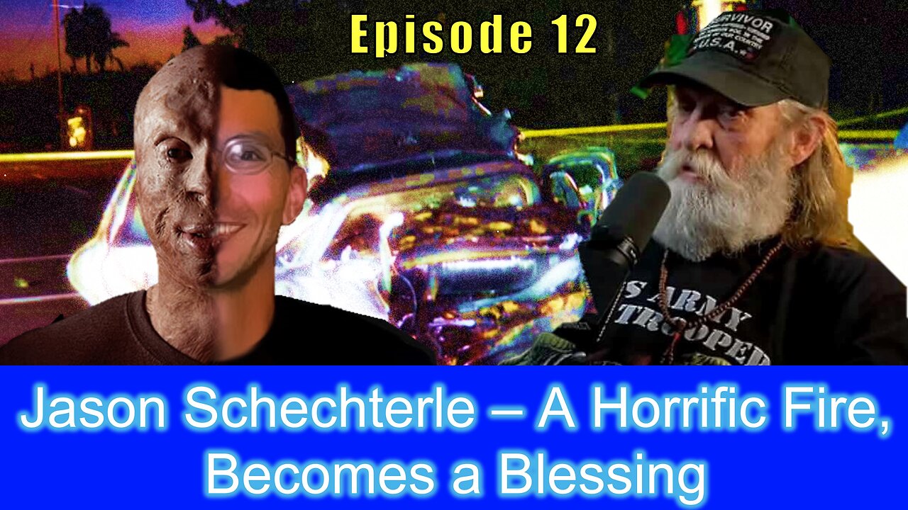 Jason Schechterle – A Horrific Fire, Becomes a Blessing